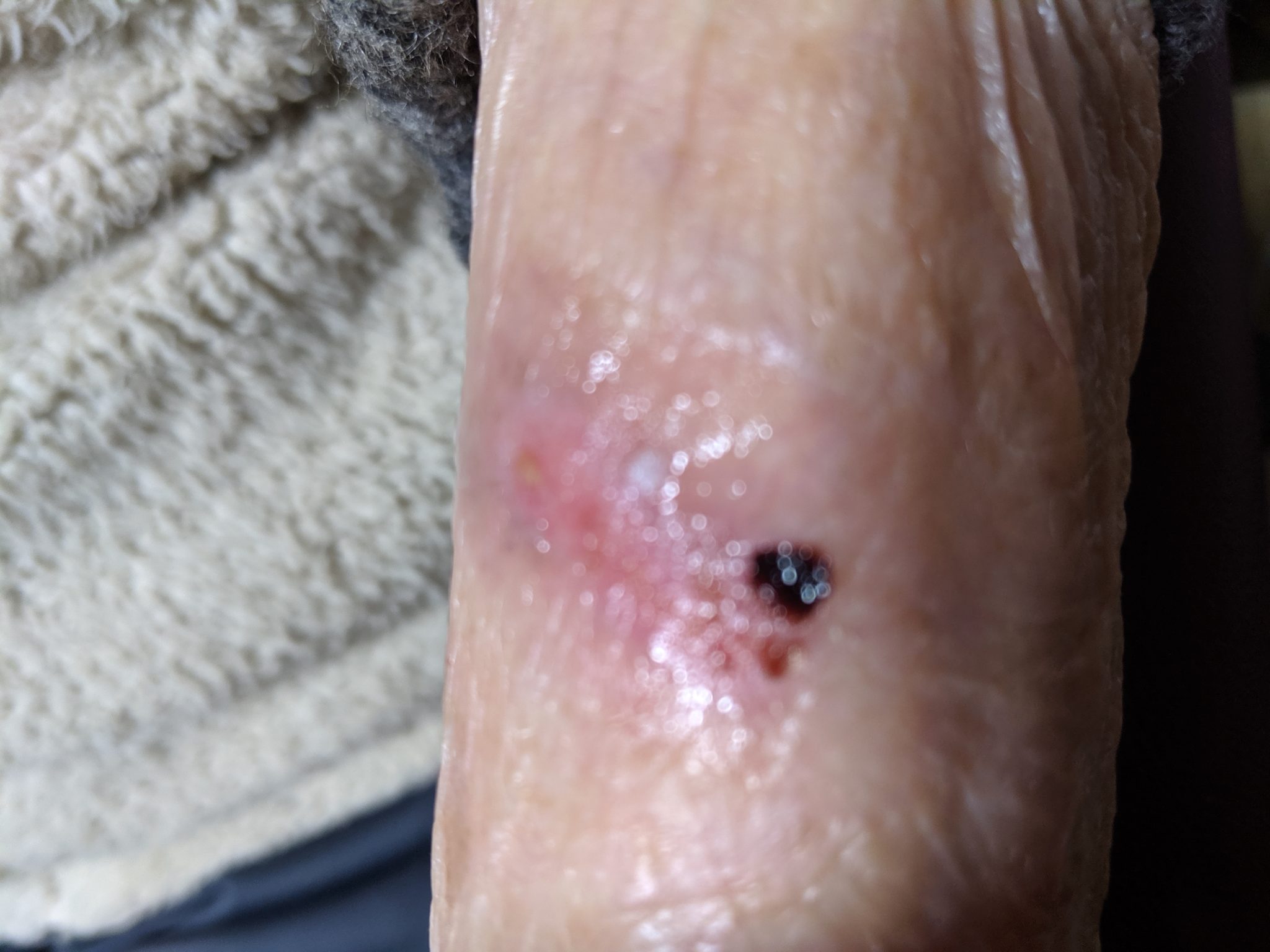 皮膚剥離の家での簡単な処置の仕方。 | トイプードルプー子と毎日オロナミンC大ばあばの喜怒哀楽ブログ